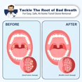 thumbnail image 4 of Tonsil Stone Remover Tonsil Stone Cleaner Fight Bad Breath Oral Irrigator Stone Removal Tool, 4 of 5