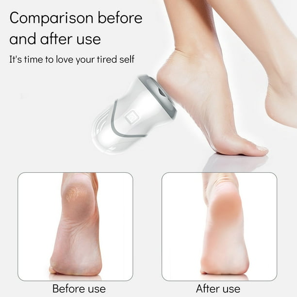 Electric Feet Callus Remover Portable Rechargeable Foot Grinder