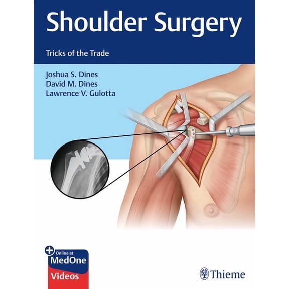 Tricks of the Trade: Shoulder Surgery: Tricks of the Trade (Hardcover)