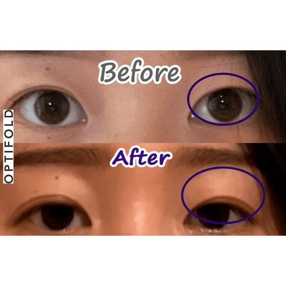 Optifold Eyelid Shaping Tapes - Fix Uneven, Hooded Eyelids or Create Double Eyelids (1 month pack)