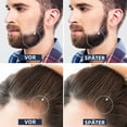 thumbnail image 4 of Rodillo para barba de 0,5 mm, Derma Roller, para el crecimiento de la barba, con microagujas para el cuidado de la piel y el cabello para hombres y mujeres, 4 of 6