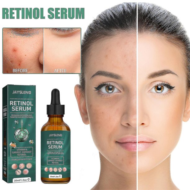 2 uds. Suero de retinol de 30ml altamente dosificado Bio con vitamina C Suero de retinol de ácido hialurónico vegano contra arrugas y ojeras Suero elevador antienvejecimiento