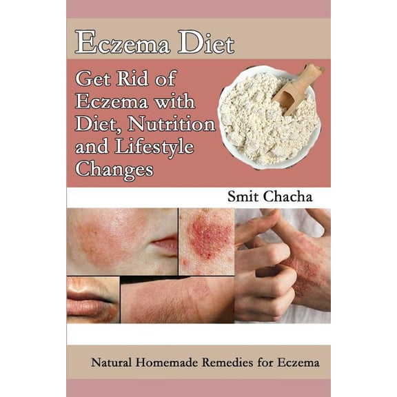 Eczema Diet - Get Rid of Eczema with Diet, Nutrition and Lifestyle Changes: Natural Homemade Remedies for Eczema, (Paperback)