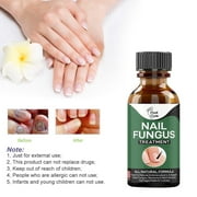 LILSHIM Nail Fungus Treatment Whitening Toe Anti Infection Nails Essence (50ml)