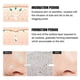 thumbnail image 3 of Blackhead Tearing Nasal Membrane Remove Blackhead Closed Mouth Acne Warm And Clean Suck Out Blackhead, 3 of 4