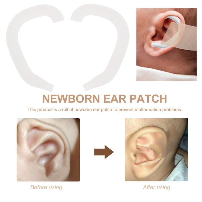 LOLIPPYY Pairs Newborn Ear Corrector White for