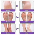 thumbnail image 3 of Ginger Foot Mask, 3 of 5