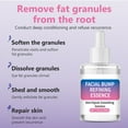 thumbnail image 3 of Milia Remover Serum,Milia Spot Removal with Salicylic Acid, Milia Acne Serum for Eyes and Face  30ML, 3 of 5