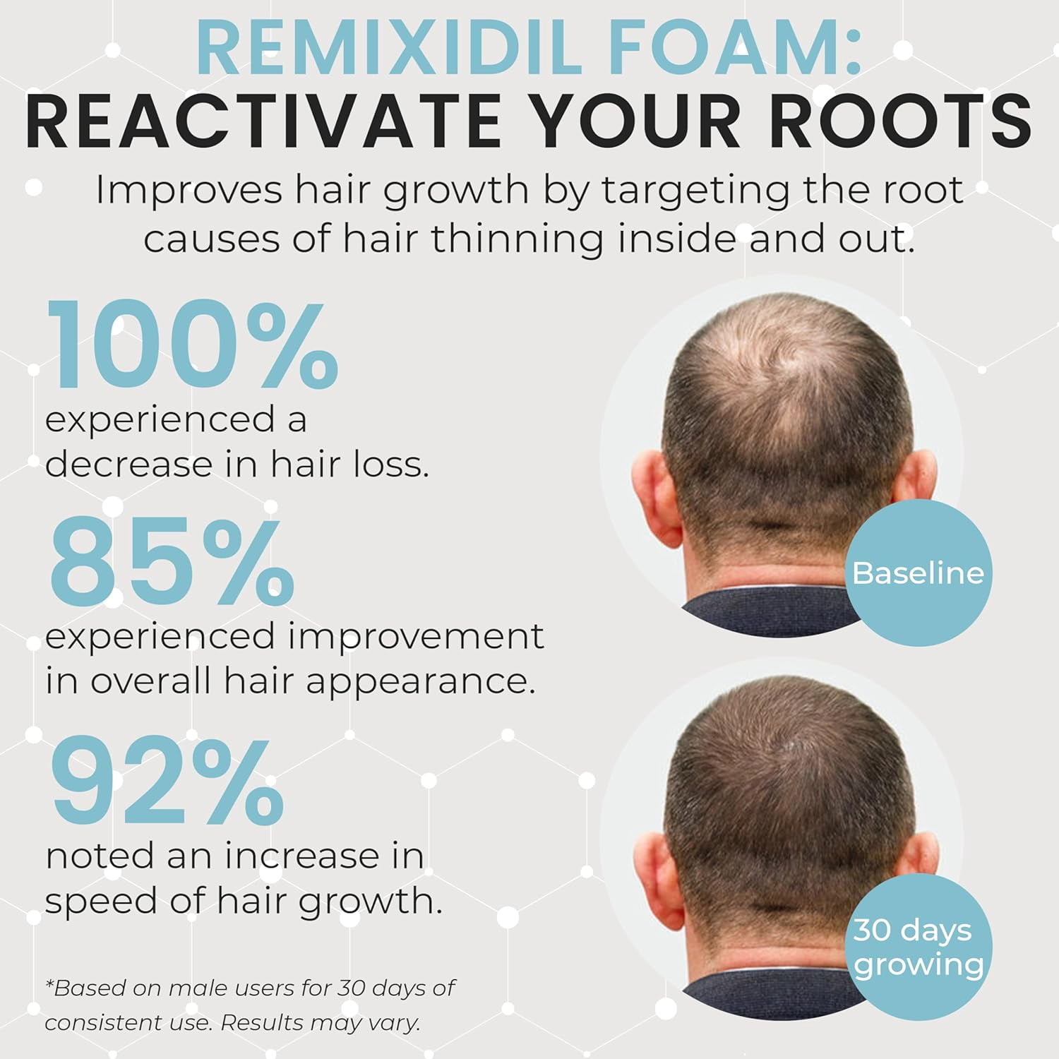 Men’s 5% Scalp Solution | Daily Leave-On Treatment for Thicker, Fuller-Looking Hair