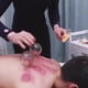 thumbnail image 5 of Juego de terapia de ahuecamiento de de 8 piezas de acupuntura china N degree 1 Zulema terapia de catación, 5 of 8