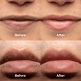 thumbnail image 4 of ABERA Fordyce Spot Lip Cream with HPR Retinoid, Moisturizing Repair For Dry Chapped Lips, 0.7 fl oz - Combo 2, 4 of 12