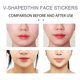 thumbnail image 3 of Face Invisible Lifting Stickers V Face Stickers Lifting Belt Plastic Stickers Tight Lifting Face Stickers With Plastic Patches, 3 of 5