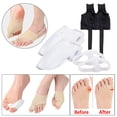 thumbnail image 3 of Kit Corrector de Juanetes Sunnimix para Hallux Valgus Alivio Antideslizante Negro L, 3 of 8