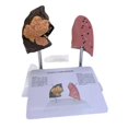 thumbnail image 5 of Smoker'S Lung Model Healthy Lung Model Lung Anatomy Model with Pathological Respiratory System Dise, 5 of 5
