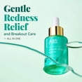 thumbnail image 3 of ANAiRUi 12% Azelaic Acid with Niacinamide Hydrating Face Serum, Lightweight Daily Facial Serum for All Skin Types, 1.05 fl oz, 3 of 9
