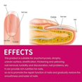 thumbnail image 5 of 1-3x OUHOE Ginger Nail Care Essence, Gray Nail Moisturizing Care Exfoliating Beauty Nail Essence, 5 of 5