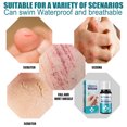 thumbnail image 3 of Skin Liquid Bandage, 10ml 2Pcs Emergency Wound Healing Liquid Bandage  for Body Health Care, 3 of 8