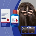 thumbnail image 5 of cuyhtdup Selenium Disulfide Oil Control Shampoo Oil Dandruff Itching Hair Care Shampoo Oil Control Refreshing Oppose-Dandruff Cleansing For Men And Women, 5 of 7