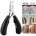 thumbnail image 6 of NiHome 14-In-1 Nail Care Set for Thick and Ingrown Nails for Men, Women, Seniors, Heavy-Duty Toenail Clipper Kit with Travel Case, Stainless Steel Trimmer, Dual Spring Cutter with Non-Slip Handle, 6 of 10