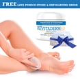 thumbnail image 2 of activelife - Revitaderm 4D Urea Cream Hidrata profundamente para pies secos y agrietados Manos Codos y rodillas Crema ultra reparadora y removedor de callos para pies Sin piedra pómez incluida 4oz 1 p, 2 of 8