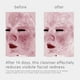 thumbnail image 3 of Limpiador facial EltaMD Skin Recovery Aminoácido 30 ml, 3 of 6