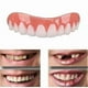 thumbnail image 2 of Dos juegos de dentaduras postizas, superior e inferior, naturales y cómodas, protegen los dientes y restauran una sonrisa segura., 2 of 2