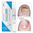 thumbnail image 4 of 5pcs 3ML Liquid Anti Nail Toenail Fungus Nail Treatment Pen Cuticle Oil, 4 of 5