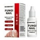 thumbnail image 1 of 15ml Fungi Nail Treatment Liquid Fast-Acting Nail Repair Strengthening Liquid Nails Care Supplies, 1 of 5
