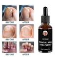 thumbnail image 4 of 2pcs Anti Fungal Nail Treatment Repair Finger Toe Care Nail Fungus Liquid, 4 of 4