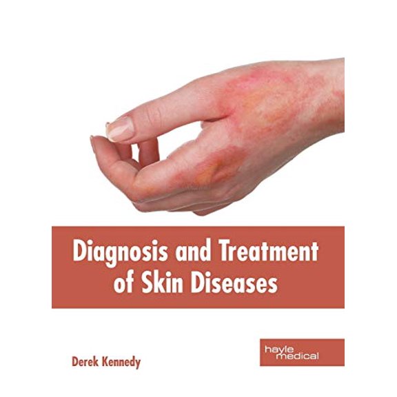 Pre-Owned Diagnosis and Treatment of Skin Diseases, 9781632415752, 1632415755, Hardcover,