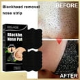 thumbnail image 6 of Deep Cleansing Nose Pore Strips 10-Pack Blackhead Removal Non-Woven Rayon Facial Treatment, 6 of 9