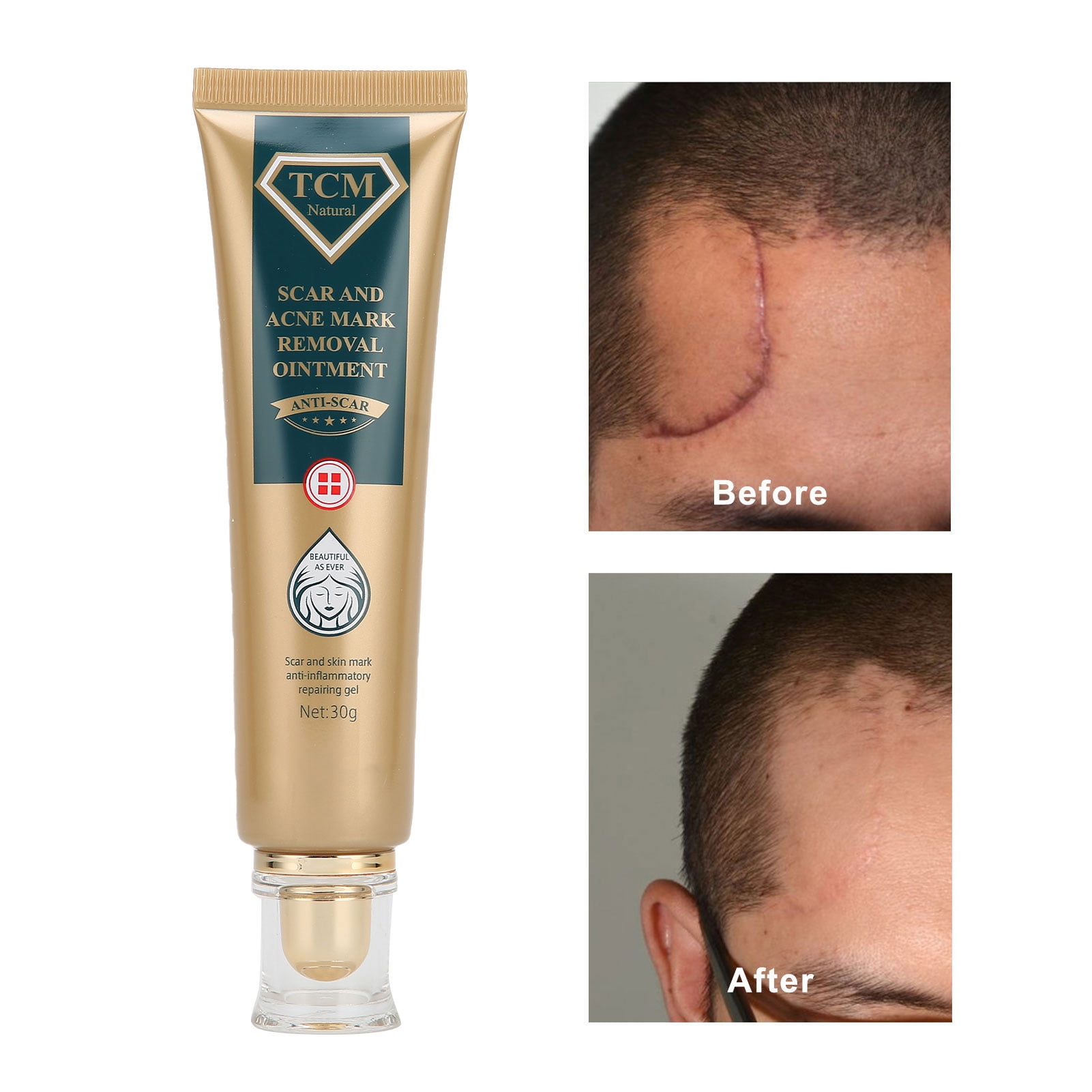 FAGINEY Elaimei 30g Scar Mark Removing Cream Hydrating Scar Fade Cream Scar Treatment Solution