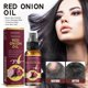 thumbnail image 1 of high qualityRed Onion Hair Growth Spray, 30ml Red Onion Hair Oil, Red Onion Hair Growth Serum, Repairs Damaged Hair, Makes Hair Thicker & Stronger, 1 of 5