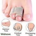 thumbnail image 3 of 6-pack Of Hammer Toe Straighteners For Straightening Hammer Toes, Broken Toes, Crooked Toes And Overlapping Toes-HYJ, 3 of 3