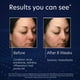 thumbnail image 4 of Crema hidratante PCA SKIN HydraMatte Oil Control 50 ml, 4 of 9