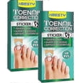 thumbnail image 1 of Ingrown Toenail Corrector Patch Pedicure, 1 of 3