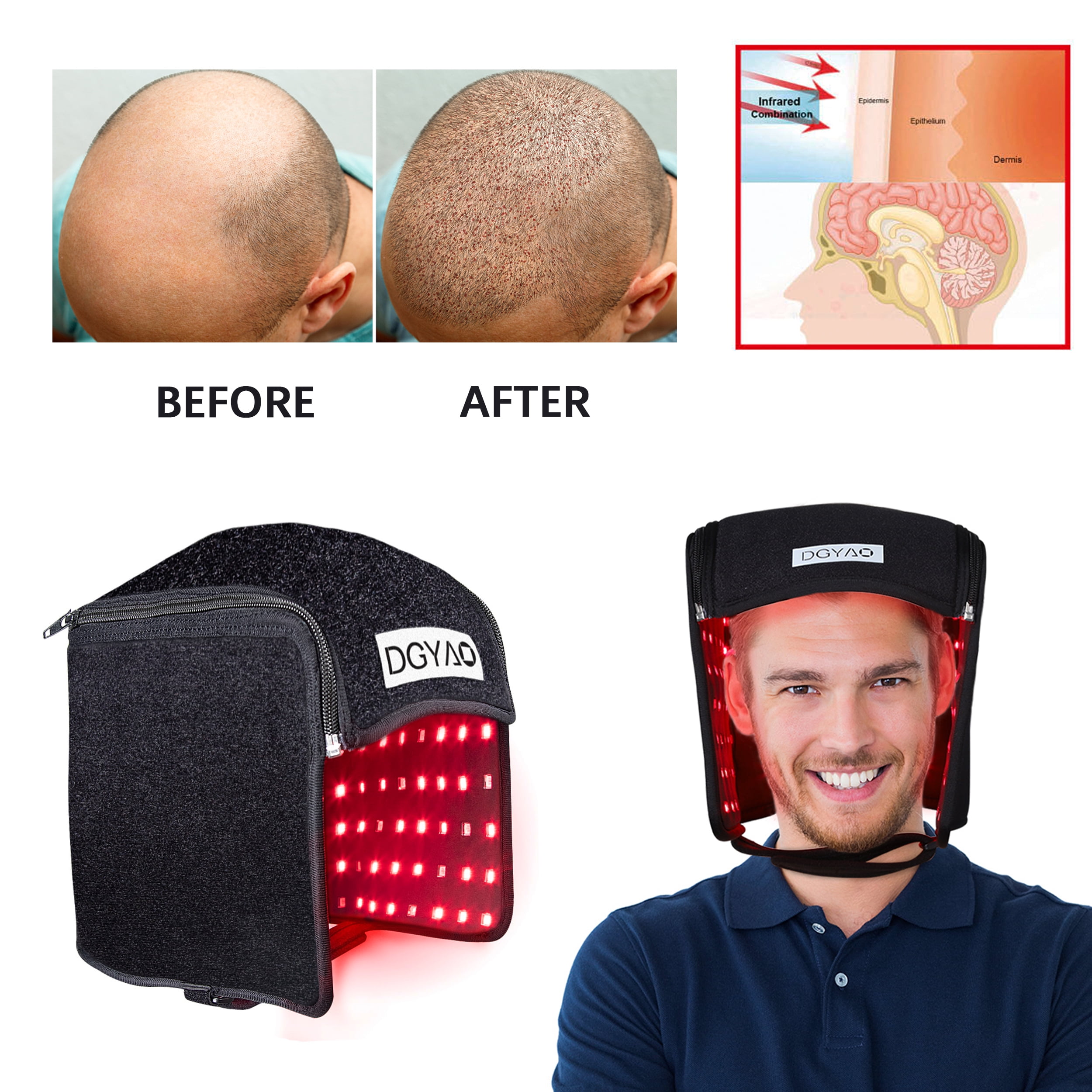 DGYAO Red Light Therapy Cap for Hair Loss Device Infrared Light