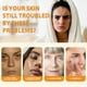 thumbnail image 5 of Clean Kojic Cleansing Pads For Face Dull Skin, Clogged Pores, Excess Oil,Dirt, Dead Skin Cells, Exfoliating, Deep Cleansing With Lemon Extract,30ml, 5 of 5