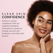 Flori Roberts Double O Complex Astringent - Facial Cleanser for Pimples - Helps Clear Acne Blemishes