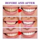 thumbnail image 4 of Pasta de dientes para blanquear los dientes Eliminación de manchas Limpieza de la cavidad oral Pasta de dientes Ygjytge Cuidado Belleza, 4 of 8