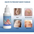 thumbnail image 2 of 1-3Pcs Ingrown Toenail Treatment Extra Strong, 20ml Ingrown Toenail Drop, Cuticle Care Oil for Ingrown Toenails, Fungal Nail Treatment, 2 of 5