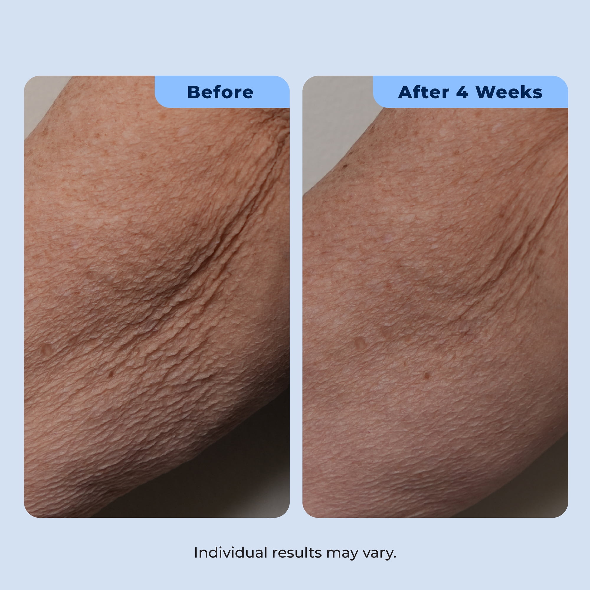 Plexaderm Dual Action Repair Cream for Neck, Chest & Arms – Firming Cream with Retinol & Bakuchiol for Crepey Skin, Fine Lines & Wrinkles