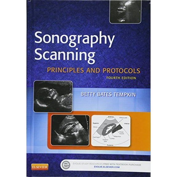 Pre-Owned Sonography Scanning: Principles and Protocols (Hardcover) 1455773212 9781455773213