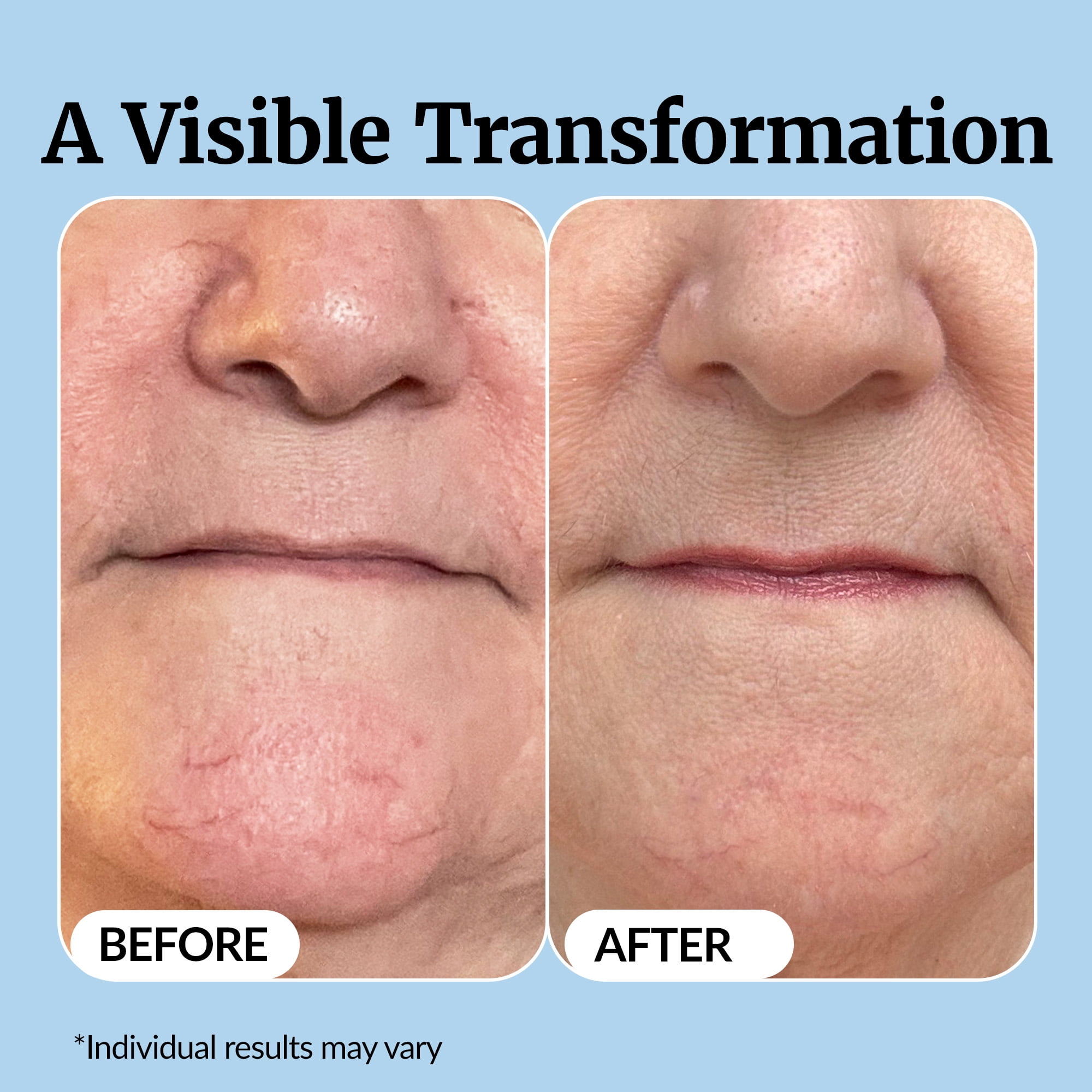 Vibriance Super C Serum for Mature Skin - All-in-One Vitamin Formula Hydrates, Firms, Lifts, Smooths, Targets Age Spots, Wrinkles, 1 fl oz - Pack of 2