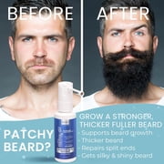 Men’s 5% Scalp Solution Minoxidils | Daily Topical Hair Care Formula for Thicker, Fuller-Looking Hair | Lightweight Scalp Care for Stronger-Looking Hair & Healthy Scalp Feel