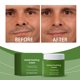 thumbnail image 5 of Plant Facial Relief Cream Relieves Tension And Improves Local Discomfort Care Cream 100g, 5 of 9