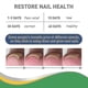 thumbnail image 4 of Pt Jaysuing Toenail Groove Correction Stickers Manicure Toenail Straightening Sticker Nail Repair Toe Ingrown Nail Correction Lala Stick, 4 of 5