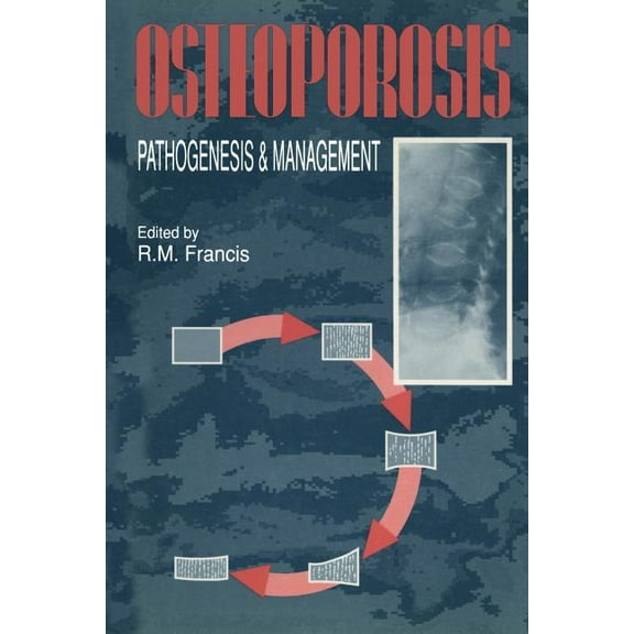 Osteoporosis: Pathogenesis and Management, (Paperback)