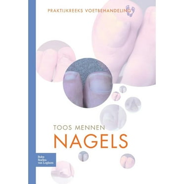 Nagels (Paperback)