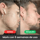 thumbnail image 3 of Apolo Cosmetics Beard Grōwth Balm - Crema estimuladora de barba ultrapotente, 3 of 6